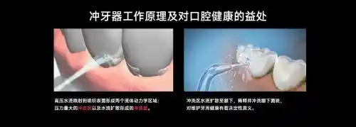 欧可林AirPump A10氧气啵啵冲牙器引领口腔护理新潮流