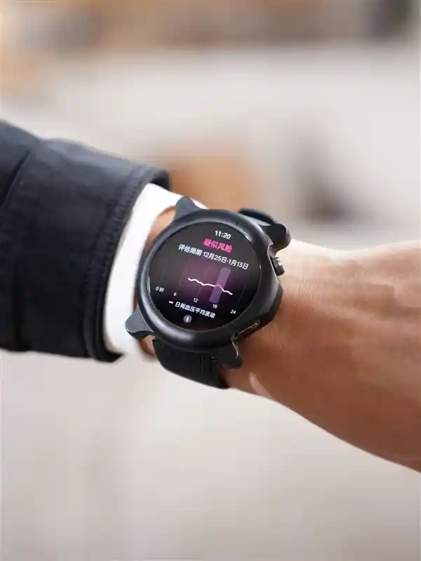 OPPO Watch X2创新支持血压监测，引领智能穿戴新风向