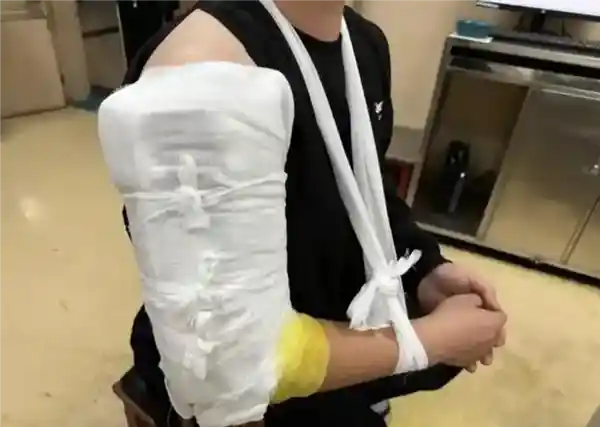机器人掰手腕大战意外收场 俩小伙惨遭双骨折